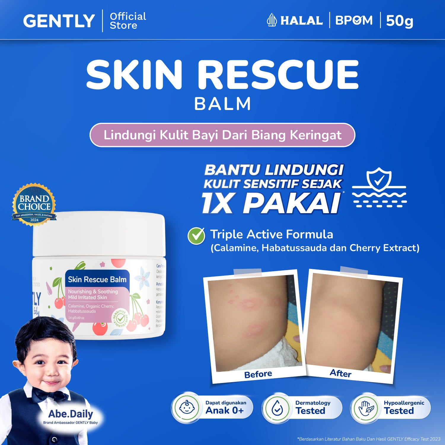 GENTLY Skin Rescue Balm
