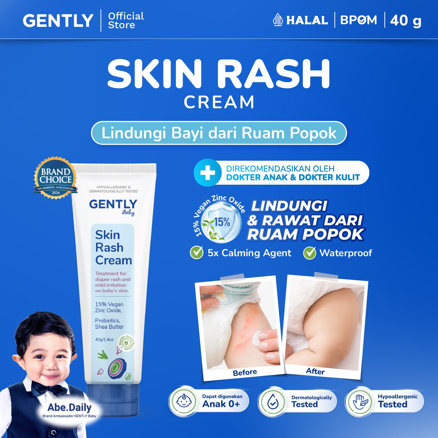 GENTLY Baby Rash Cream 40gr