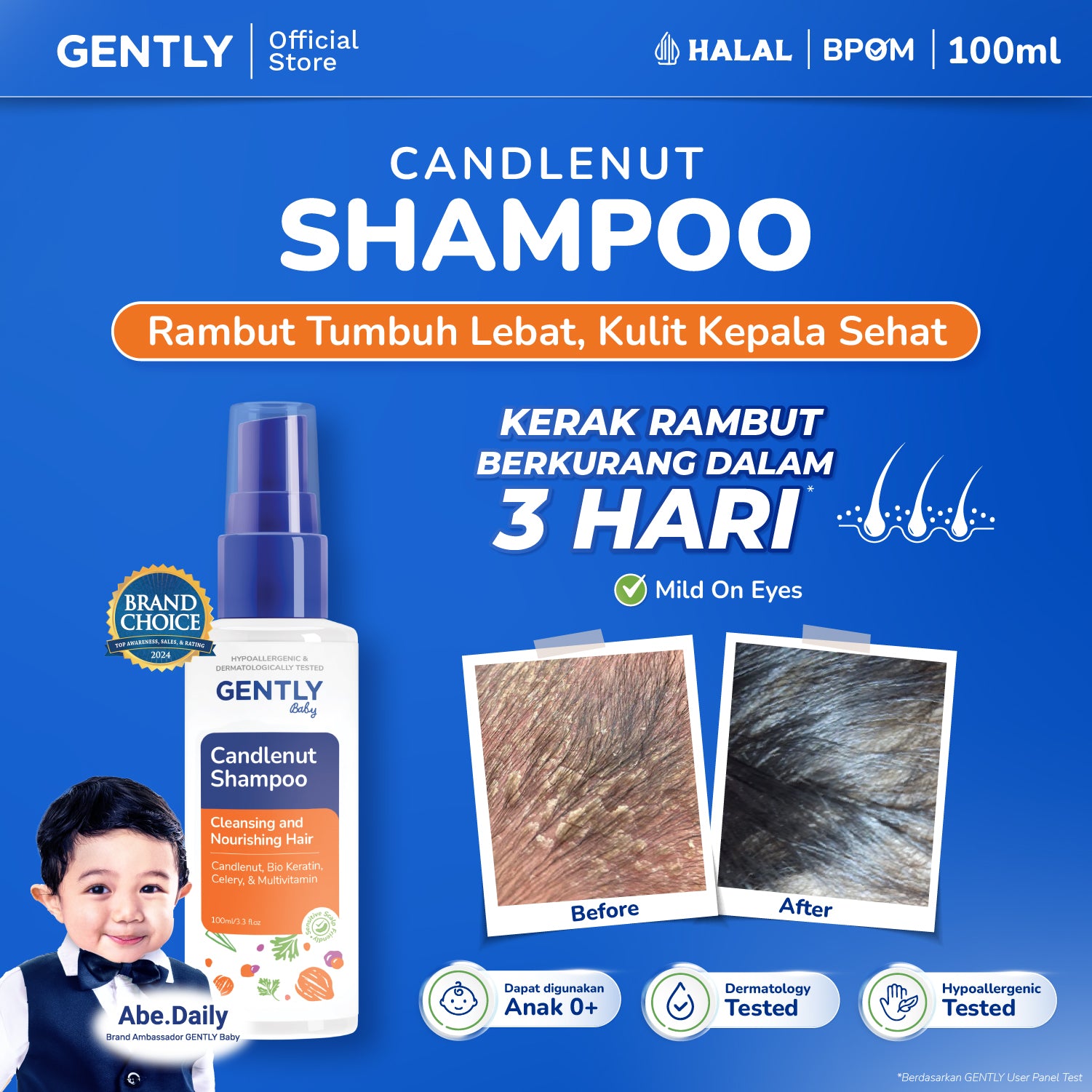 GENTLY Candlenut Shampoo 100ml