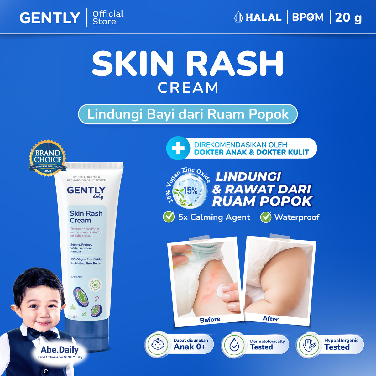 GENTLY Baby Rash Cream 20gr