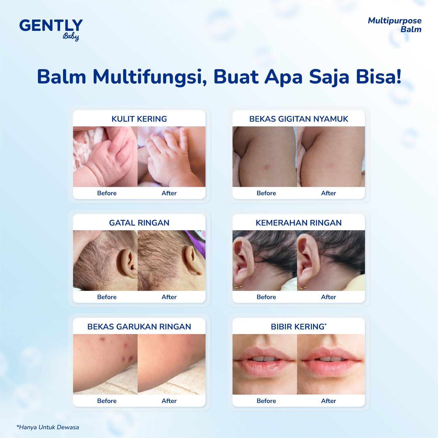 GENTLY Baby Multipurpose Balm 12gr - Baby Balm Multifungsi dengan New Zealand Manuka Honey | 5x Ceramides | Untuk Kulit Sensitif & Kering