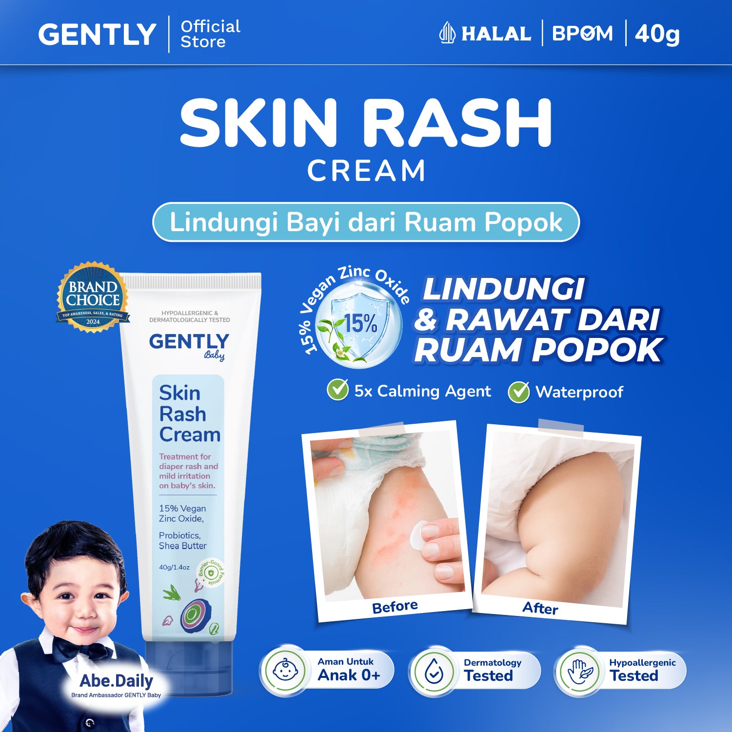 GENTLY Baby Rash Cream 40gr