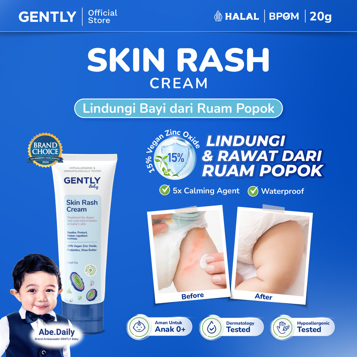 GENTLY Baby Rash Cream 20gr