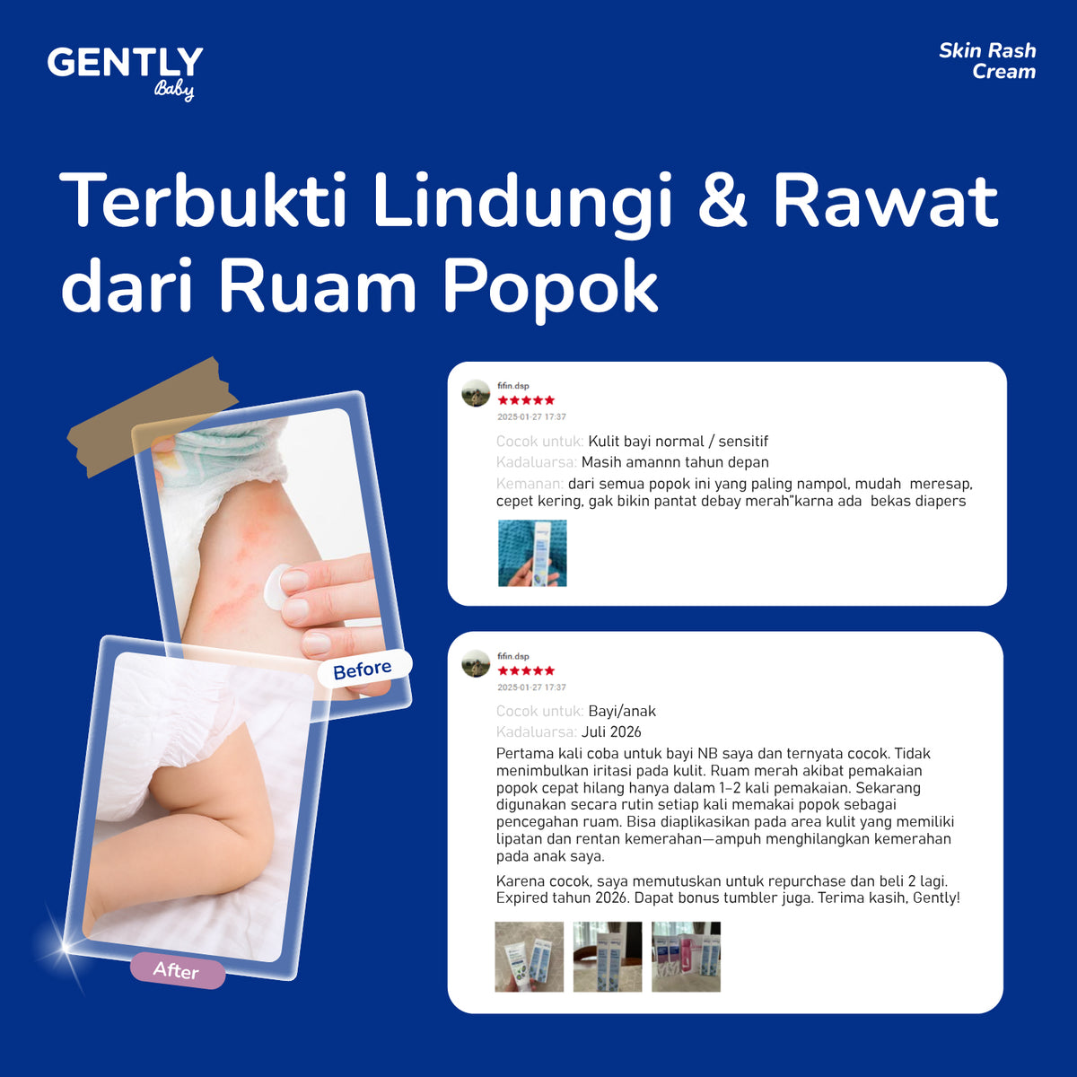 GENTLY Baby Rash Cream 40gr