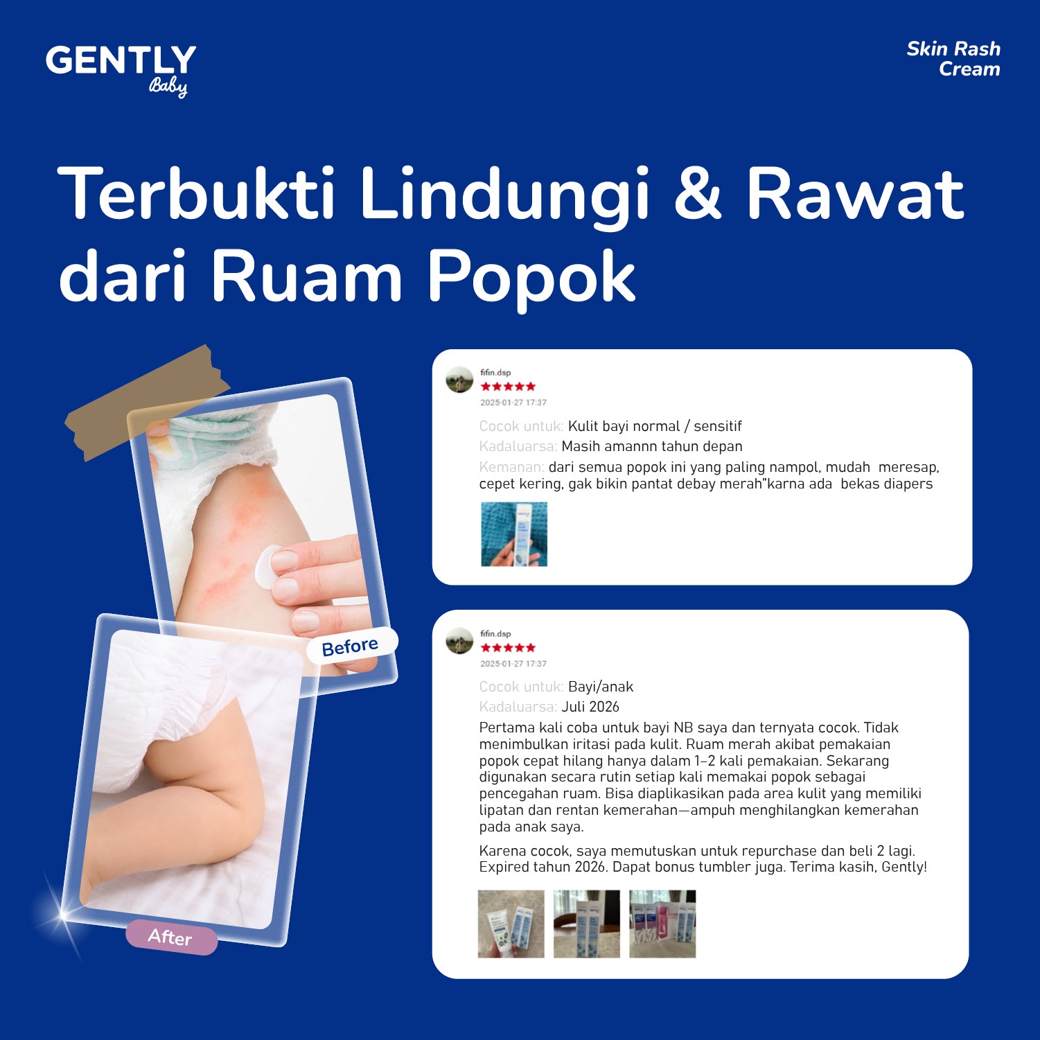 GENTLY Baby Rash Cream 40gr